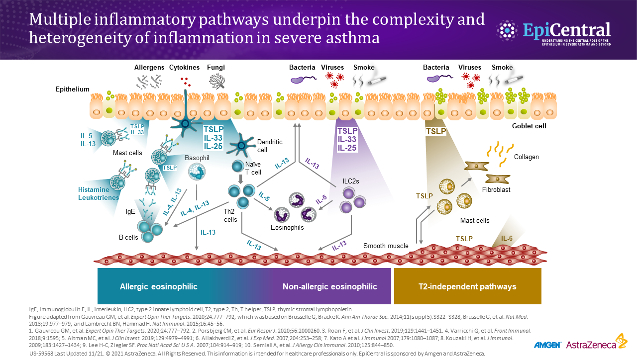 Complexity Of Severe Asthma Az Epicentral Us